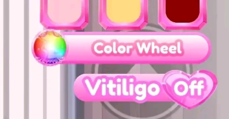 Vitiligo option during early Summer 2024