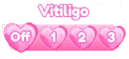 Vitiligo Options