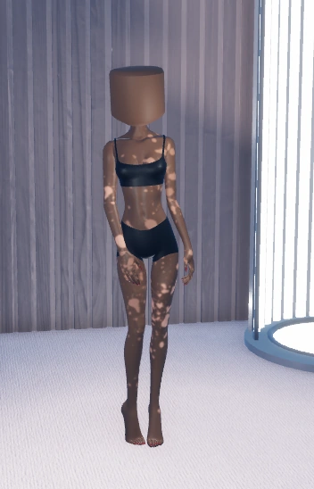 Vitiligo concept